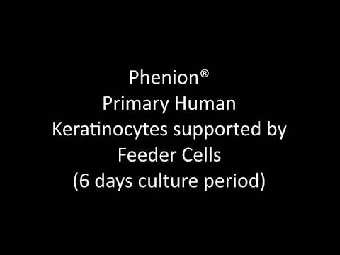 Primary Human Keratinocytes supported by Feeder Cells - Thumbnail