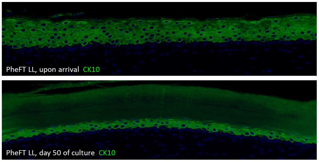 Cytokeratin 10 is located in all supra-basal living layers of the epidermis