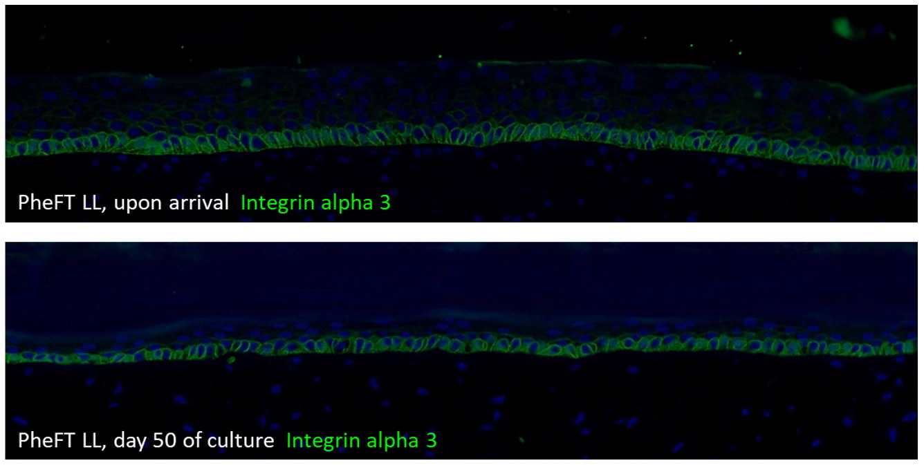 Integrin alpha 3 is located on the surface of the basal keratinocytes and acts as a major component of the cell adhesion complex