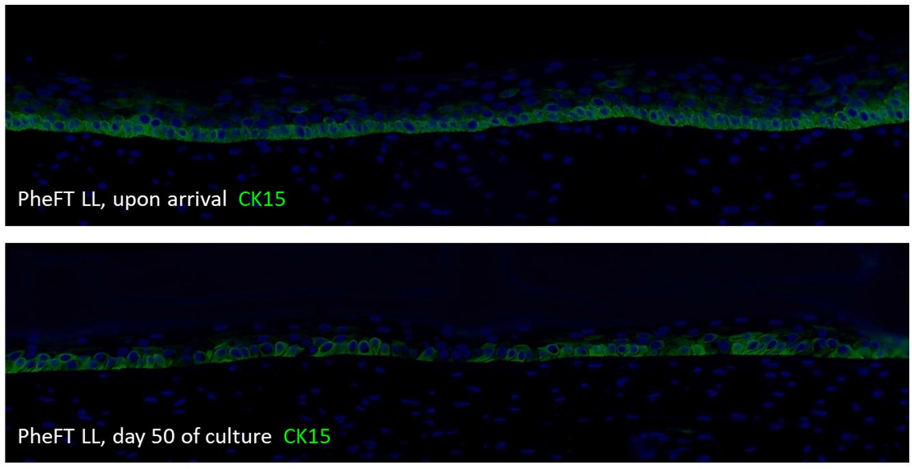 Cytokeratin 15 is expressed as stem cell marker in the basal keratinocytes