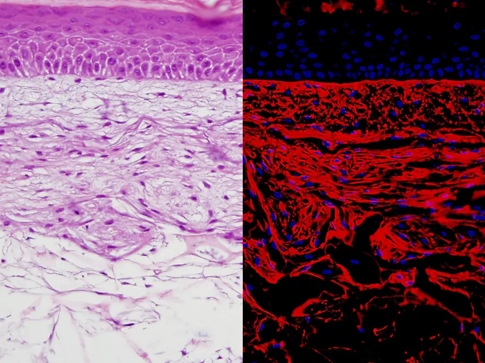 combination-image