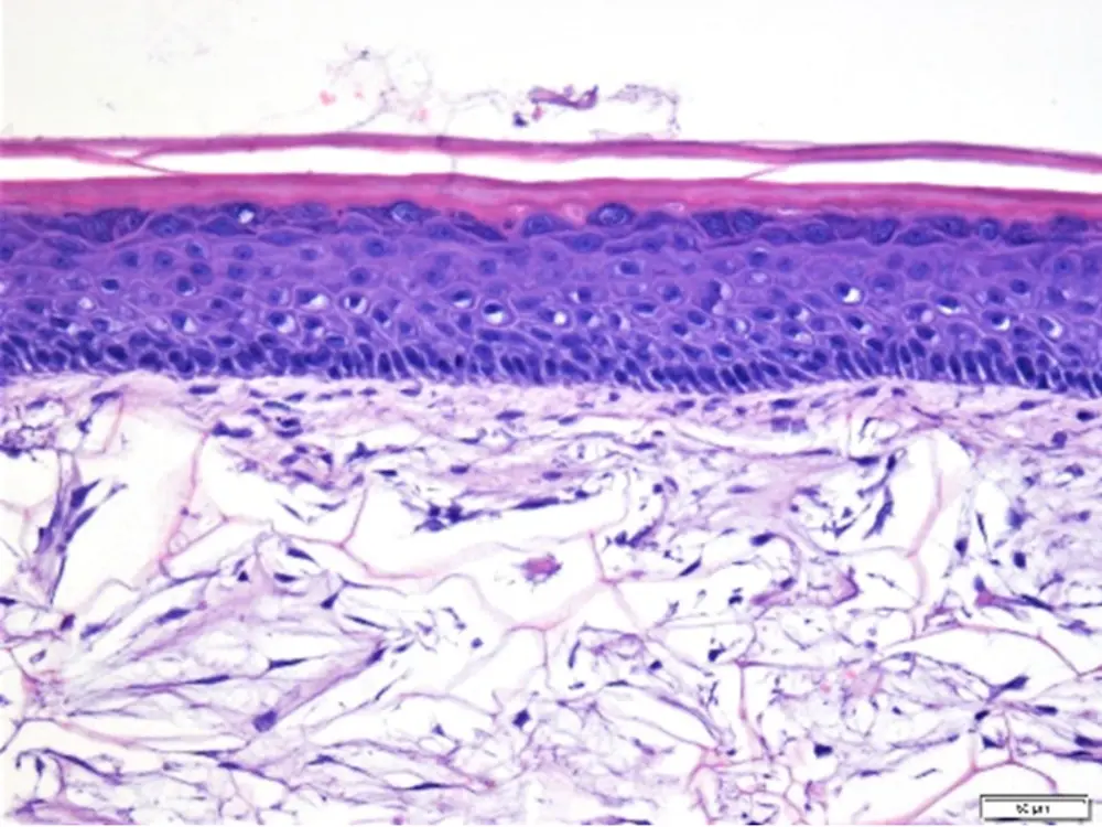 Phenion® FT Skin Model: Tissue architecture
