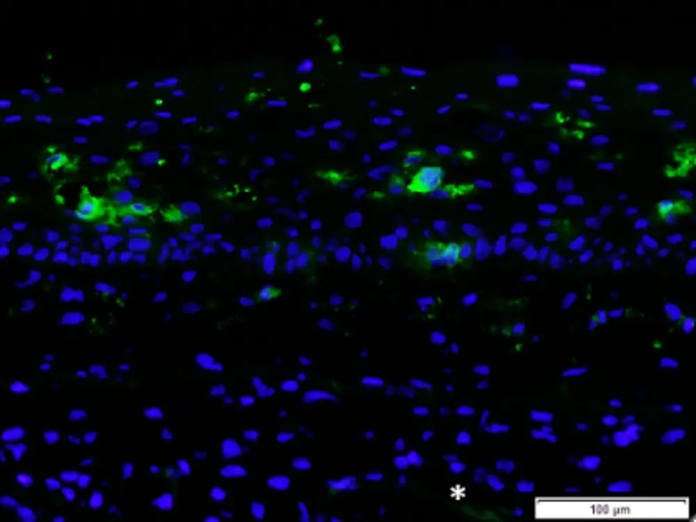 Phenion FT Skin Model with integrated MUTZ-LC’s, labelled for CD1a (green fluorescent cells in the epidermis; cells counterstained