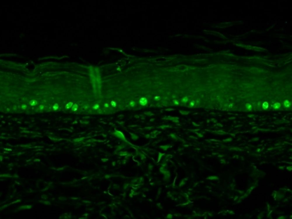 Ki67 antibody localizes proliferating basal keratinocytes in the epidermis.