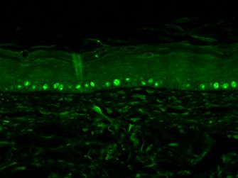 Ki67 antibody localizes proliferating basal keratinocytes in the epidermis.
